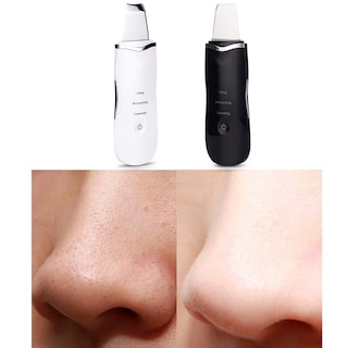 Foto 2 | Pala Ultrasónica Para Limpieza De Puntos Negros Limpieza De La Piel Beauty Instr - Venta Internacional.