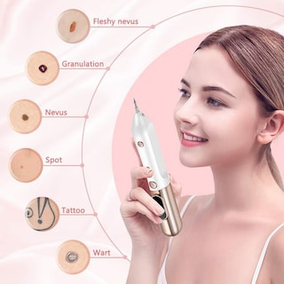 Foto 4 | Lápiz De Plasma Para Tatuaje De Lunares Pecas Y Verrugas Color Dorado - Venta Internacional.