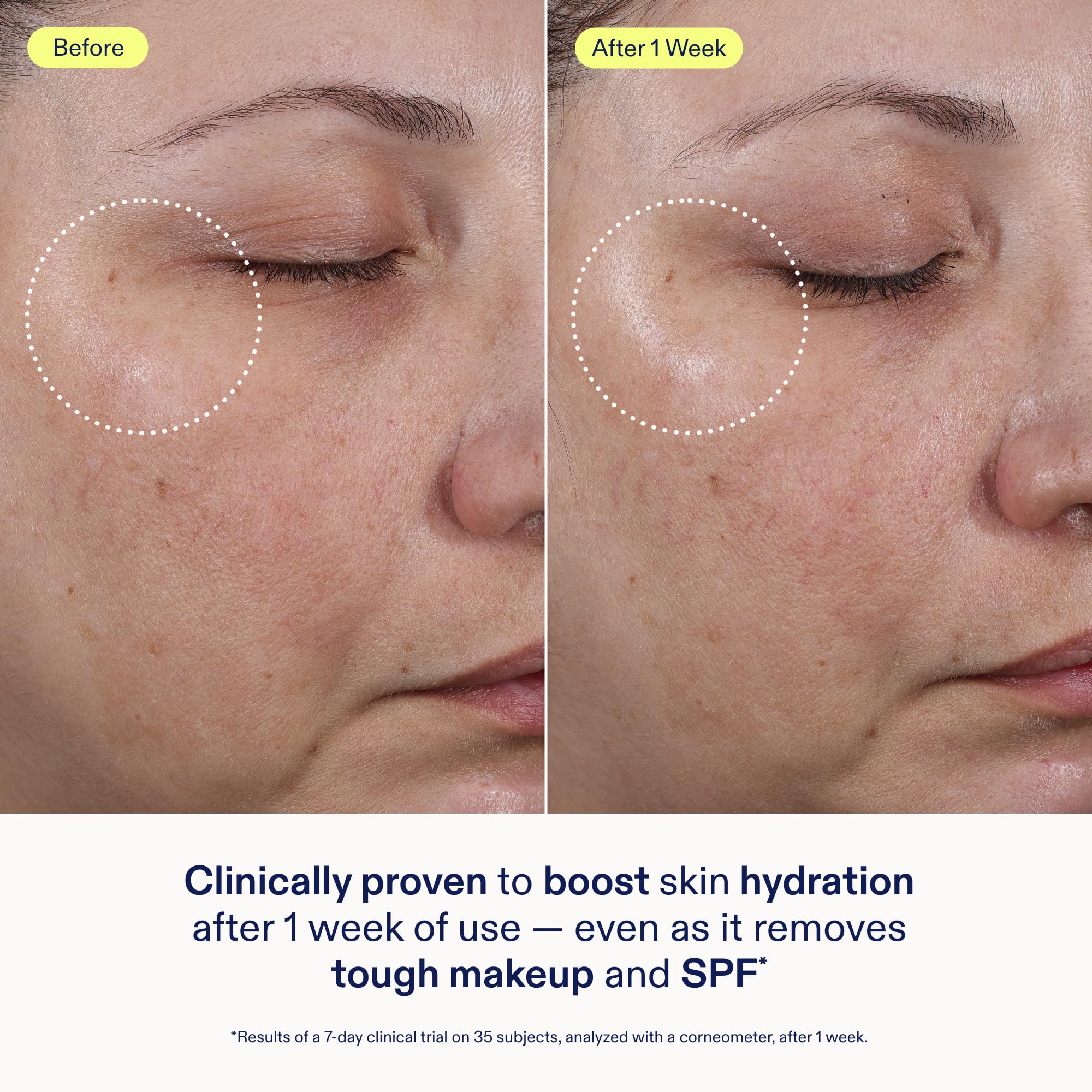 Foto 5 pulgar | Gel Suave Limpiador Skinfix Ceramide + Ectoin  45 Ml  Vegano - Venta Internacional.
