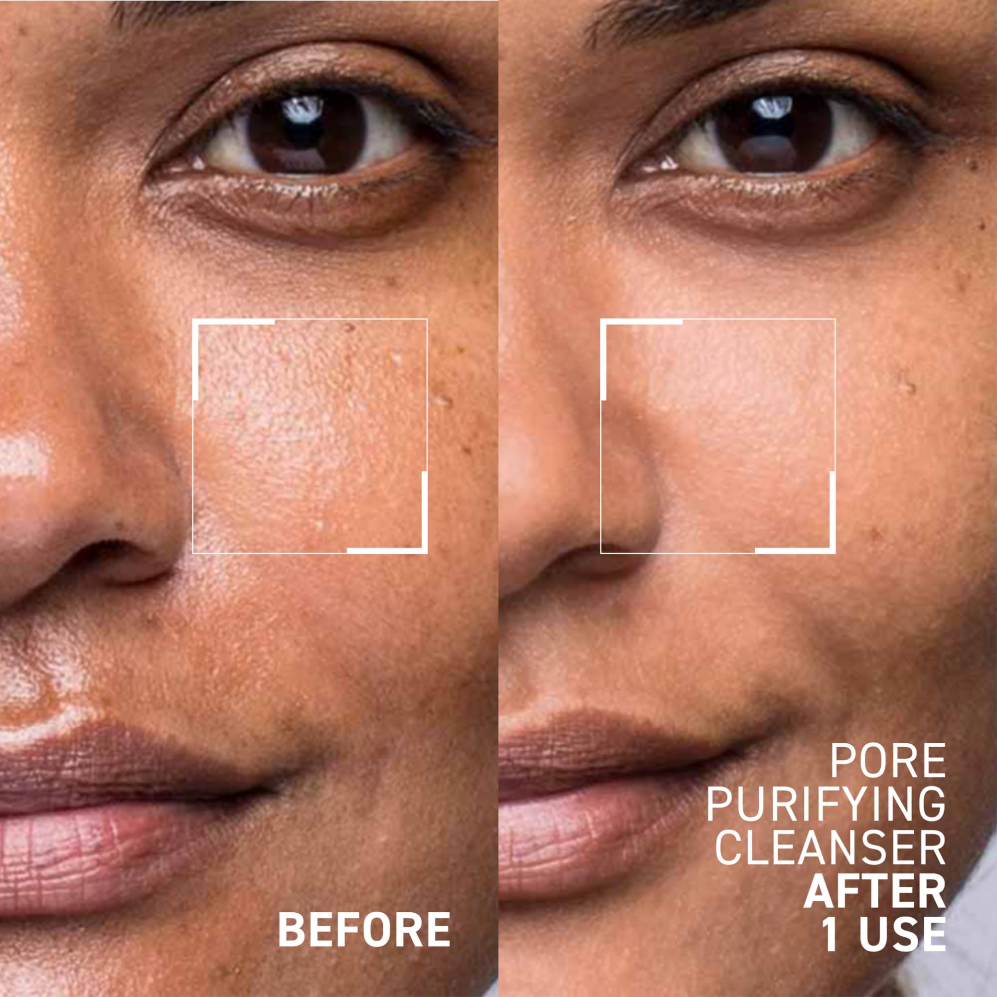 Foto 4 pulgar | Gel Purificador De Poros Cleanser Dr. Brandt Pores No More  100 Ml  2 - Venta Internacional.