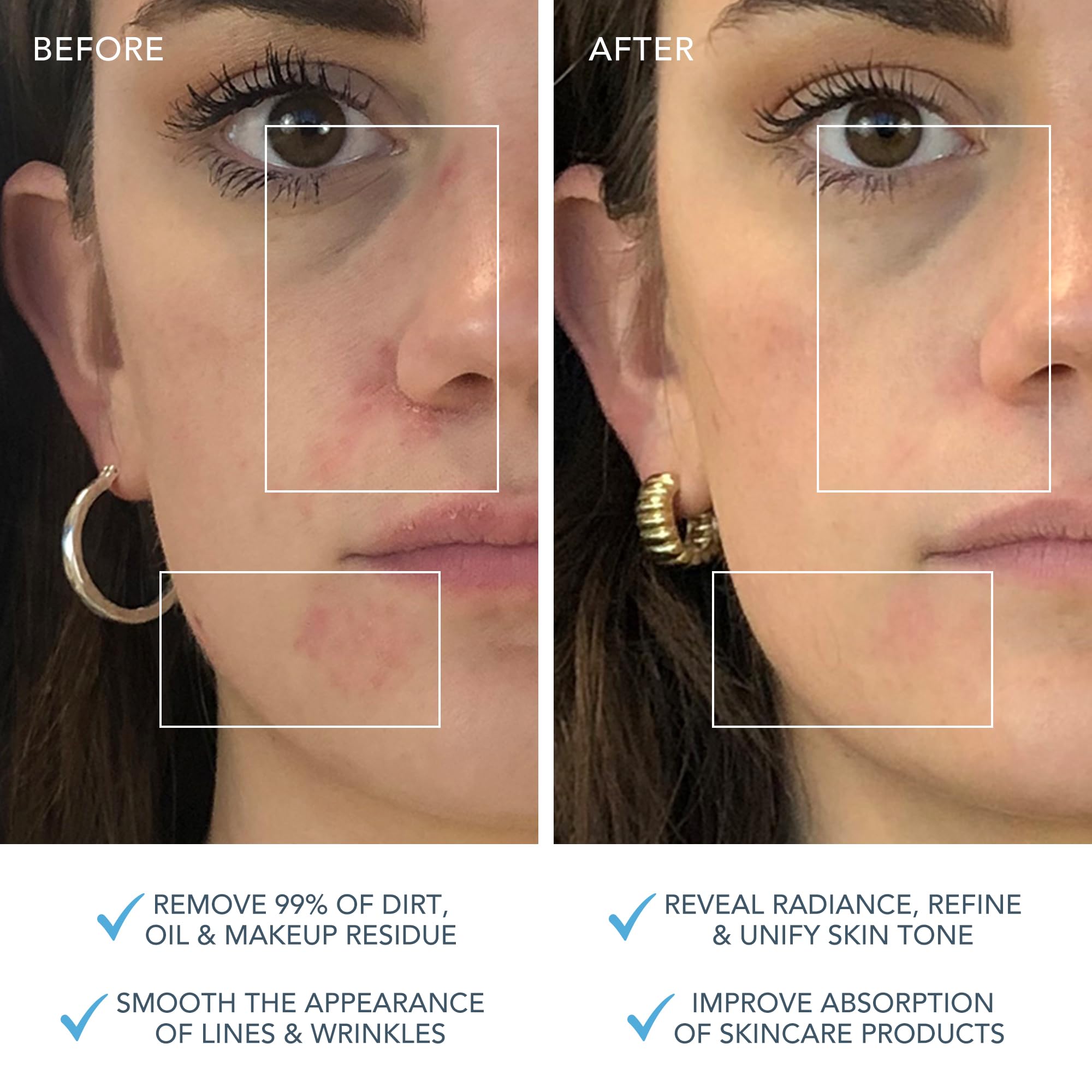 Foto 4 | Cepillo Limpiador Facial Foreo Luna 3 Para Pieles Mixtas - Venta Internacional.