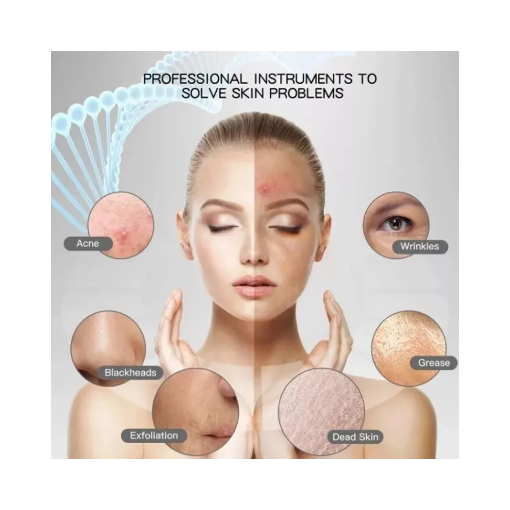 Foto 6 pulgar | Limpiador Facial Belug Peeling Ultrasónico Portatil Skin Scrubber Rosa Detalles Plata Morado Y Azul