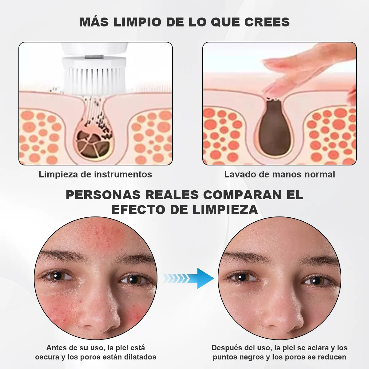 Foto 4 pulgar | Cepillo Facial Belug Eléctrico Recargable