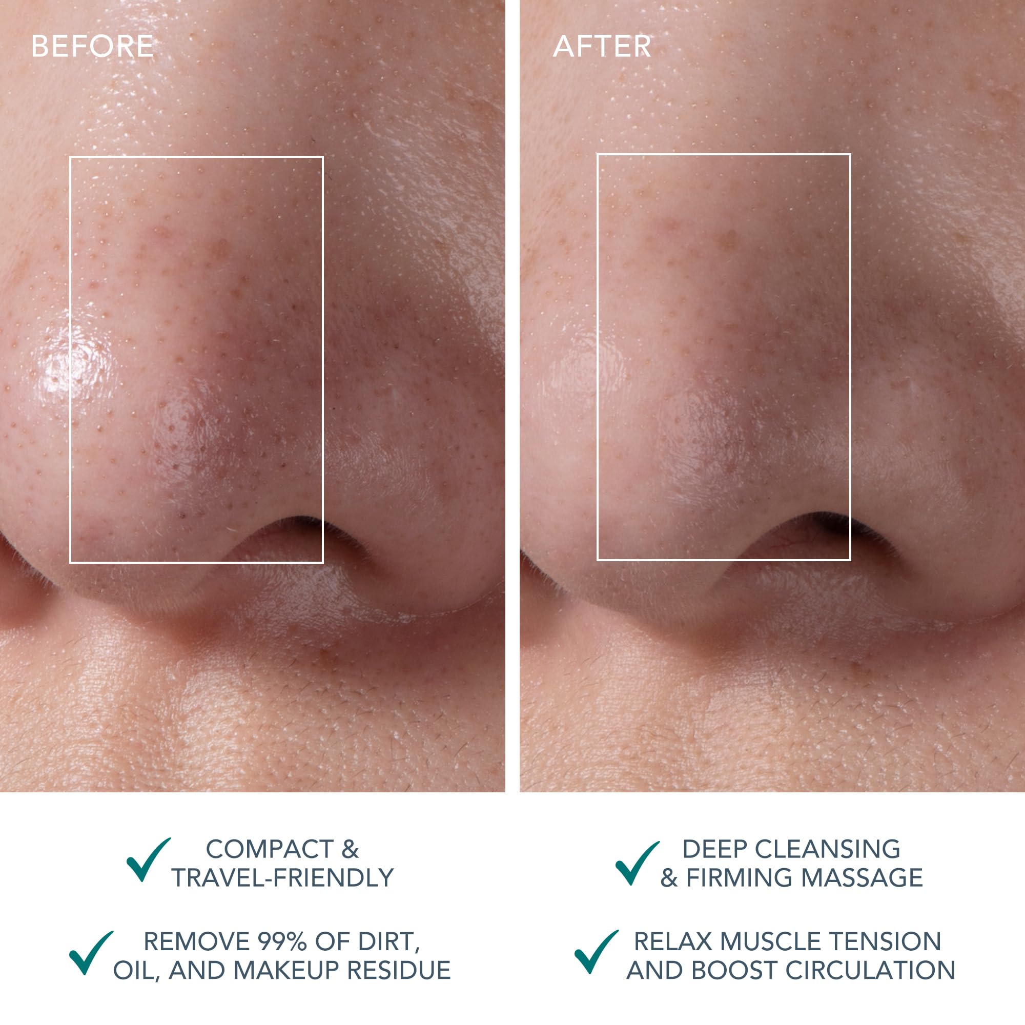 Foto 6 pulgar | Cepillo Limpiador Facial Y Masajeador Facial Reafirmante Foreo Luna 4 Go - Venta Internacional.