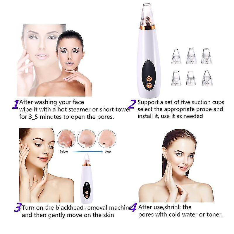 Foto 6 pulgar | Limpiador Facial Eliminador De Puntos Negros Huoguo Beauty Device - Venta Internacional.
