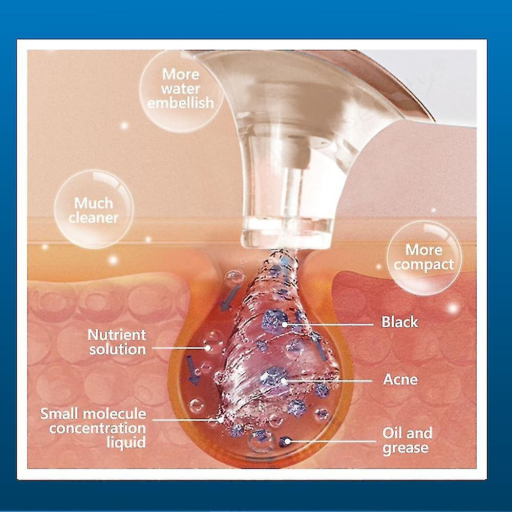 Foto 4 pulgar | Limpiador Facial  Eliminador De Puntos Negros  Aspiradora Eléctrica - Venta Internacional.
