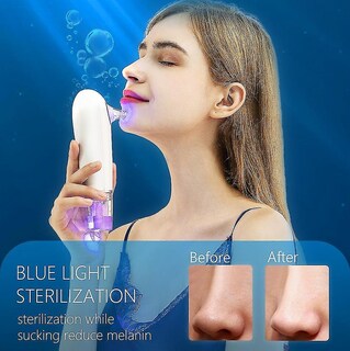 Foto 4 | Limpiador Facial Eliminador De Puntos Negros Aspiradora Eléctrica - Venta Internacional.