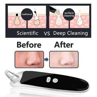 Foto 3 | Aspiradora Eléctrica Para Eliminar Puntos Negros Facial Cleansers - Venta Internacional.