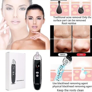 Foto 2 | Aspirador Limpiador Facial Eliminador De Puntos Negros Huoguo - Venta Internacional.