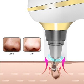 Foto 2 | Limpiadores Faciales Con Aspiración Profunda Eliminador De Puntos Negros Mediante Usb - Venta Internacional.