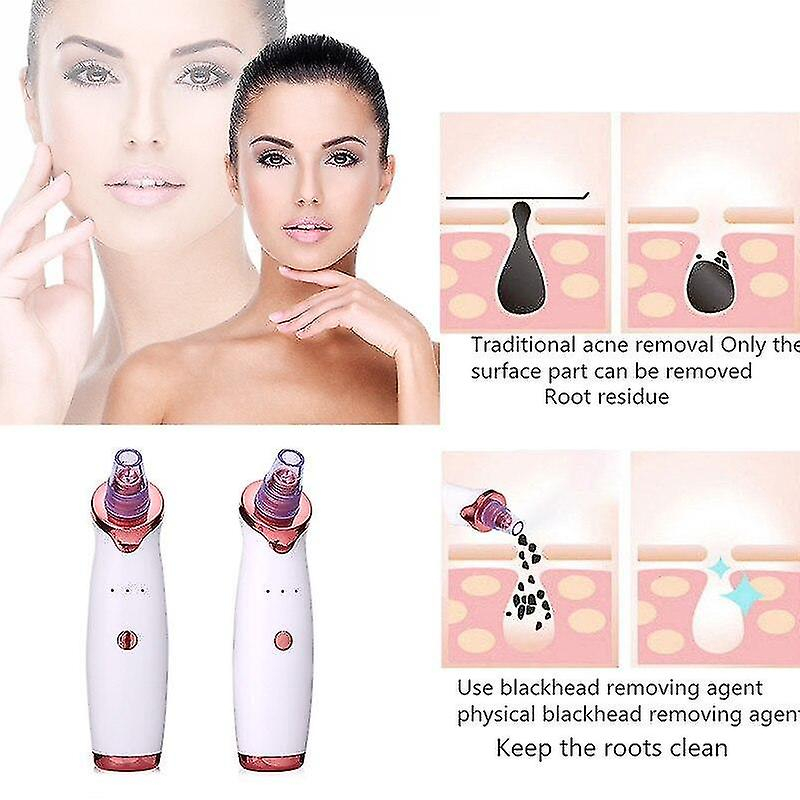 Foto 5 pulgar | Limpiador Facial Con Aspiradora Eléctrica Para Eliminar Puntos Negros Huoguo - Venta Internacional.