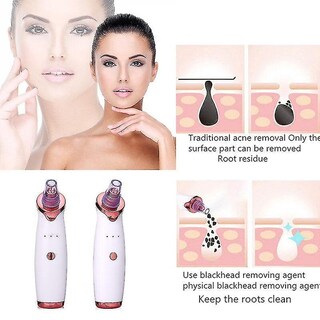 Foto 4 | Limpiador Facial Con Aspiradora Eléctrica Para Eliminar Puntos Negros Huoguo - Venta Internacional.