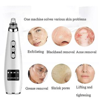 Foto 2 | Limpiador Facial Con Aspiradora Eléctrica Para Eliminar Puntos Negros Huoguo - Venta Internacional.