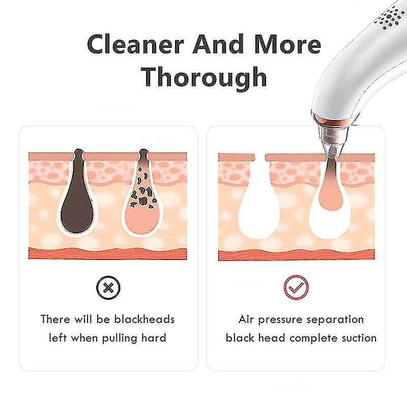 Foto 4 pulgar | Limpiador Facial Eliminador De Puntos Negros Huoguo Vacuum Suction - Venta Internacional.