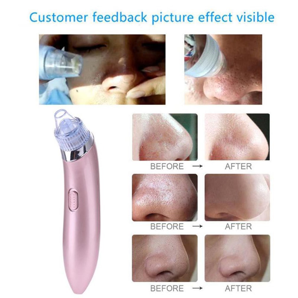 Foto 5 | Beauty Device Blackhead Pore Cleaner Darwell  Versión En Inglés - Venta Internacional.