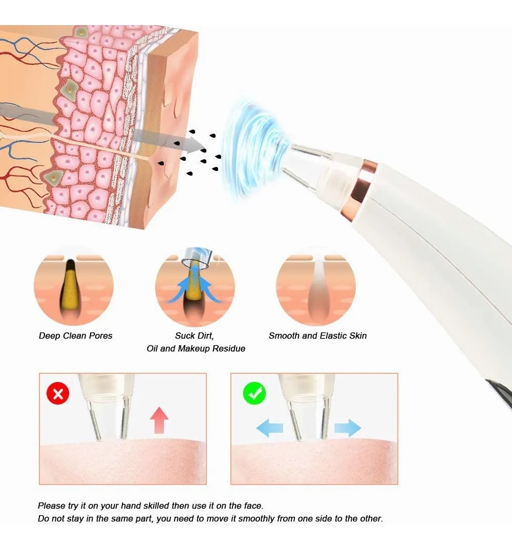 Foto 4 pulgar | Limpiador de Poros 6 en1 Malubero Removedor de Espinilla