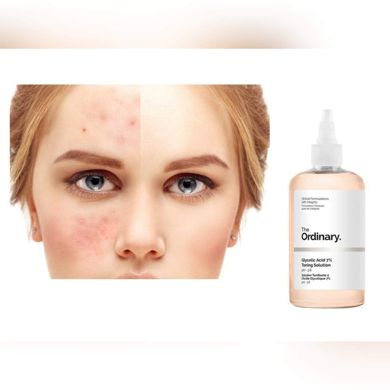 Foto 6 | Solución Tonificante The Ordinary Glicolic Acid 7% 240 Ml - Venta Internacional