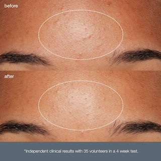 Foto 7 | Exfoliante Facial Microfoliante Diario Exfoliator Dermalogica 75 ml - Venta Internacional