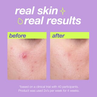 Foto 2 | Liquid Peel Dermalogica Clear Start Breakout Clearing, 30 Ml - Venta Internacional.