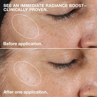 Foto 6 | Exfoliante Facial Clinique Clinique Clarifying Lotion Dry Combination - Venta Internacional.