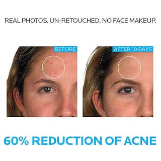 Foto 2 | Sistema De Tratamiento Del Acné La Roche-posay Effaclar, 3 Pasos, 2 Meses - Venta Internacional.