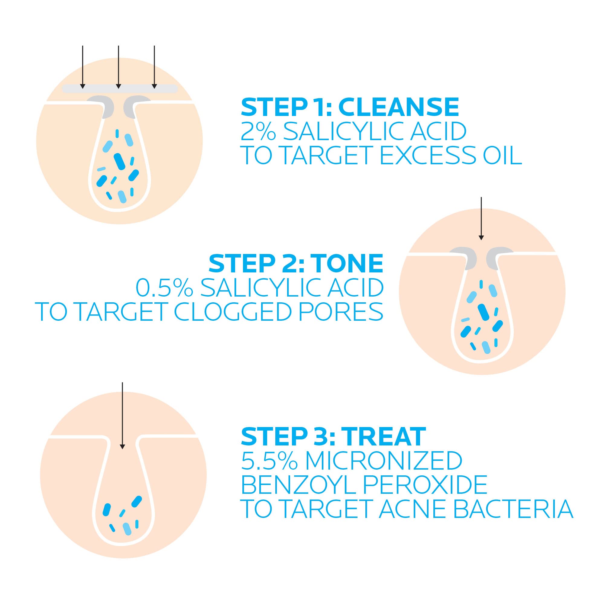 Foto 4 | Sistema De Tratamiento Del Acné La Roche-posay Effaclar, 3 Pasos, 2 Meses - Venta Internacional.