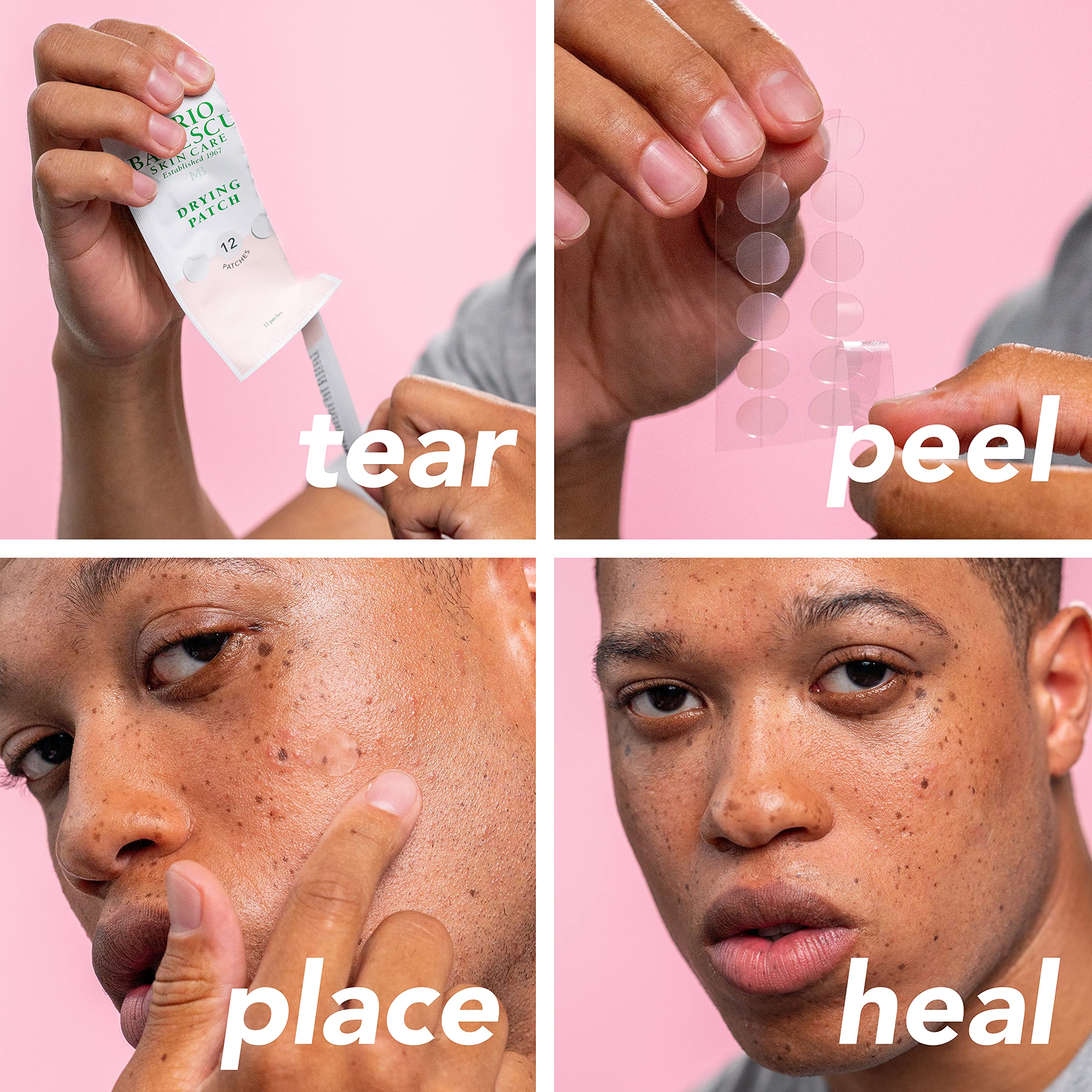 Foto 7 pulgar | Parche Seco Que Cubre Las Imperfecciones De Mario Badescu Con Vitamina C - Venta Internacional.