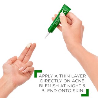 Foto 6 | Corrector De Manchas Vichy Normaderm S.o.s Acne Rescue 10% De Azufre - Venta Internacional.
