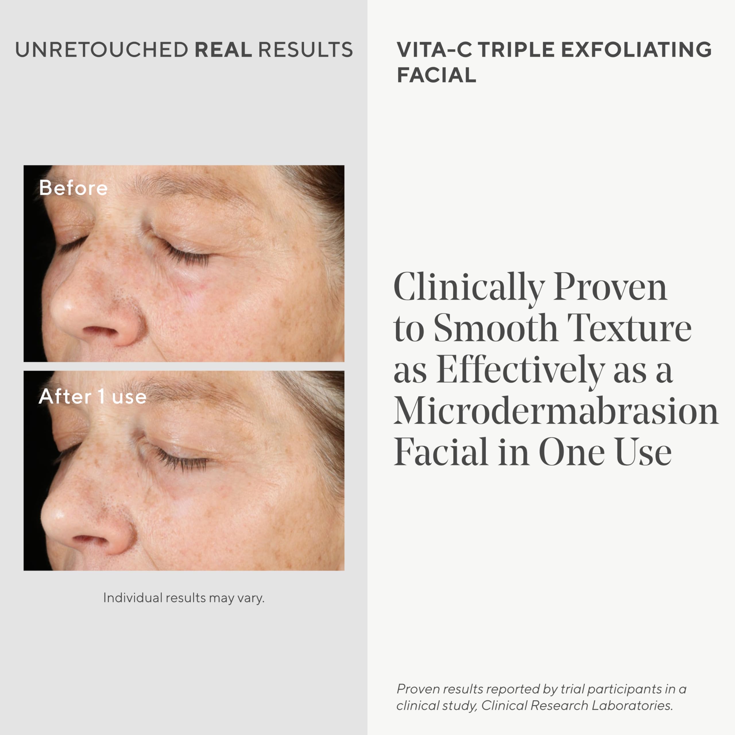Foto 4 pulgar | Exfoliante Facial Murad Environmental Shield Vita-c Triple Exfoliante - Venta Internacional.