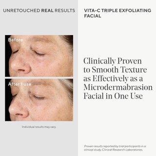 Foto 3 | Exfoliante Facial Murad Environmental Shield Vita-c Triple Exfoliante - Venta Internacional.
