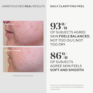 Foto 3 | Solución Exfoliante Murad Daily Clarifying Retinoide Rejuvenecedor 100 Ml - Venta Internacional