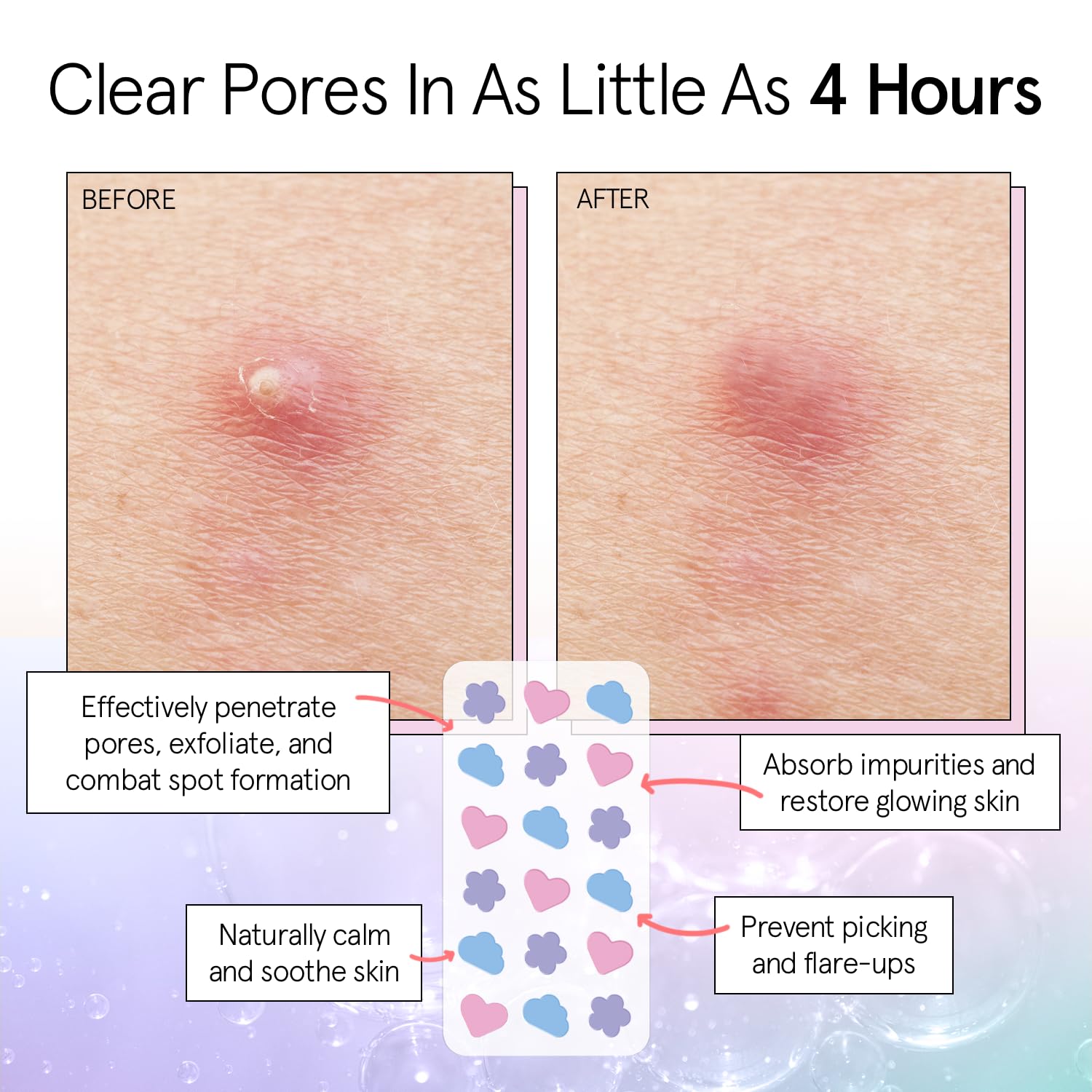Foto 4 pulgar | Pimple Patches, Ganadora Del Premio Grace & Stella Por Face 36 Count - Venta Internacional.