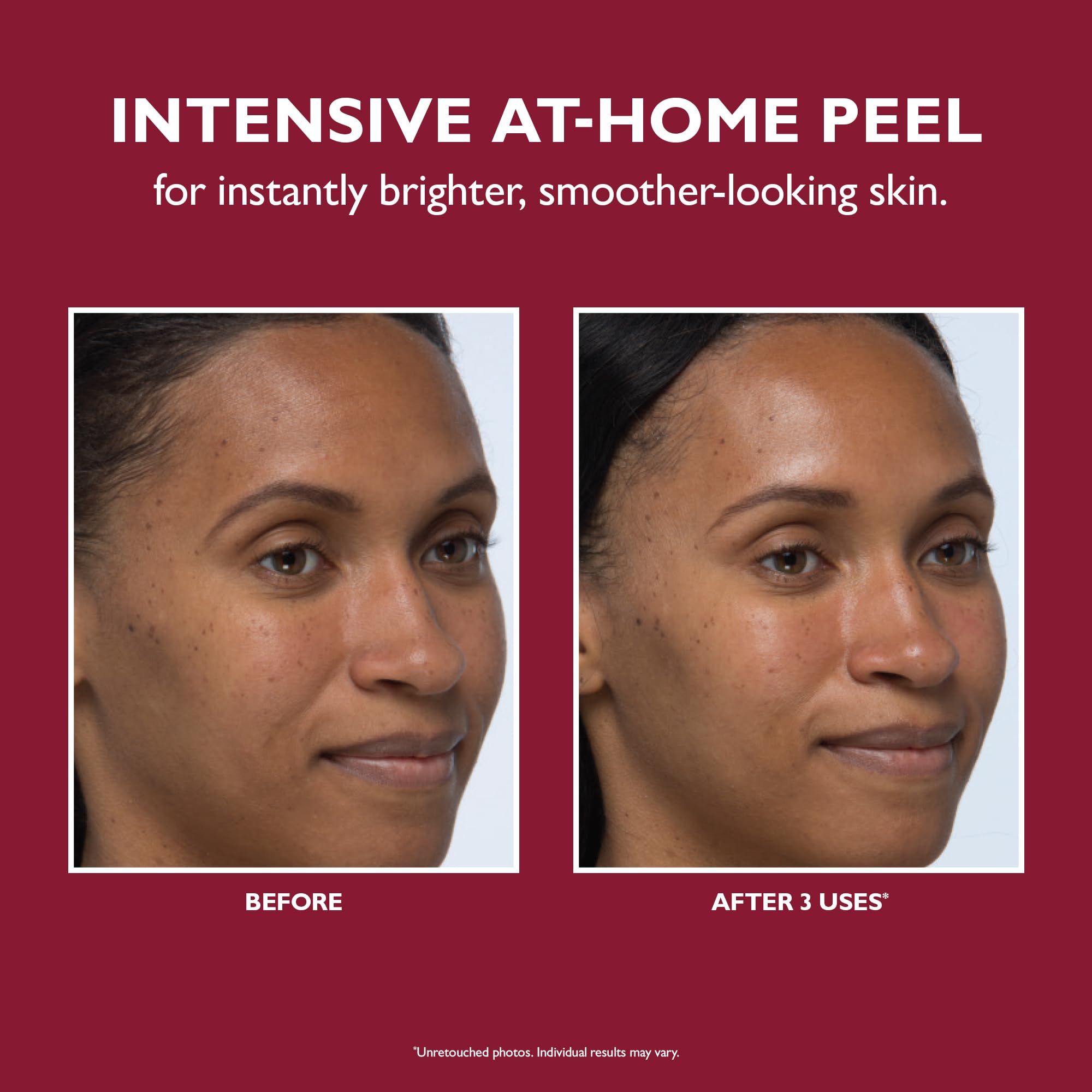 Foto 7 pulgar | Exfoliación Facial Peter Thomas Roth: Revelación Instantánea Aún Más Suave - Venta Internacional.
