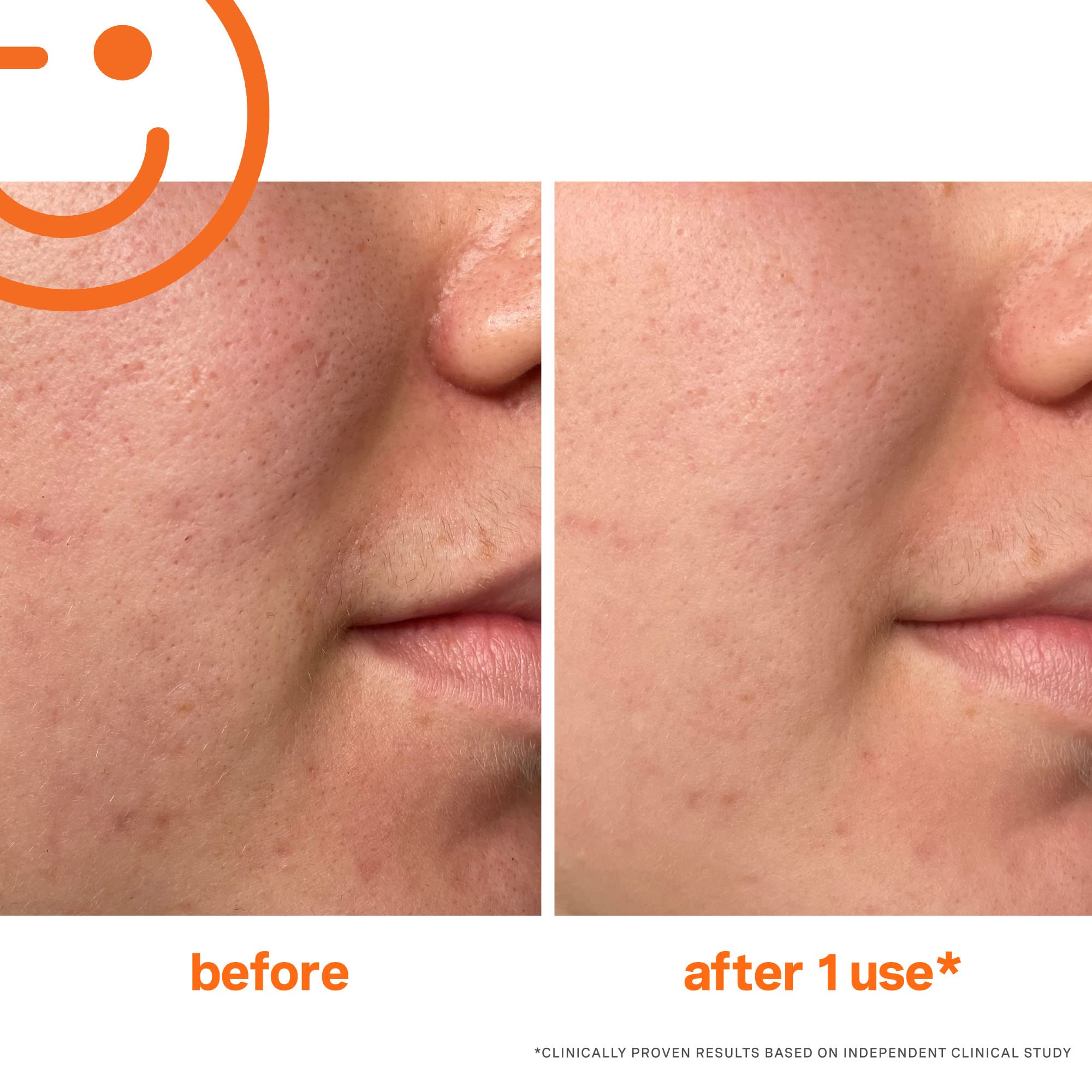 Foto 7 pulgar | Tratamiento Exfoliante Kate Somerville Exfolikate 60 Ml - Venta Internacional