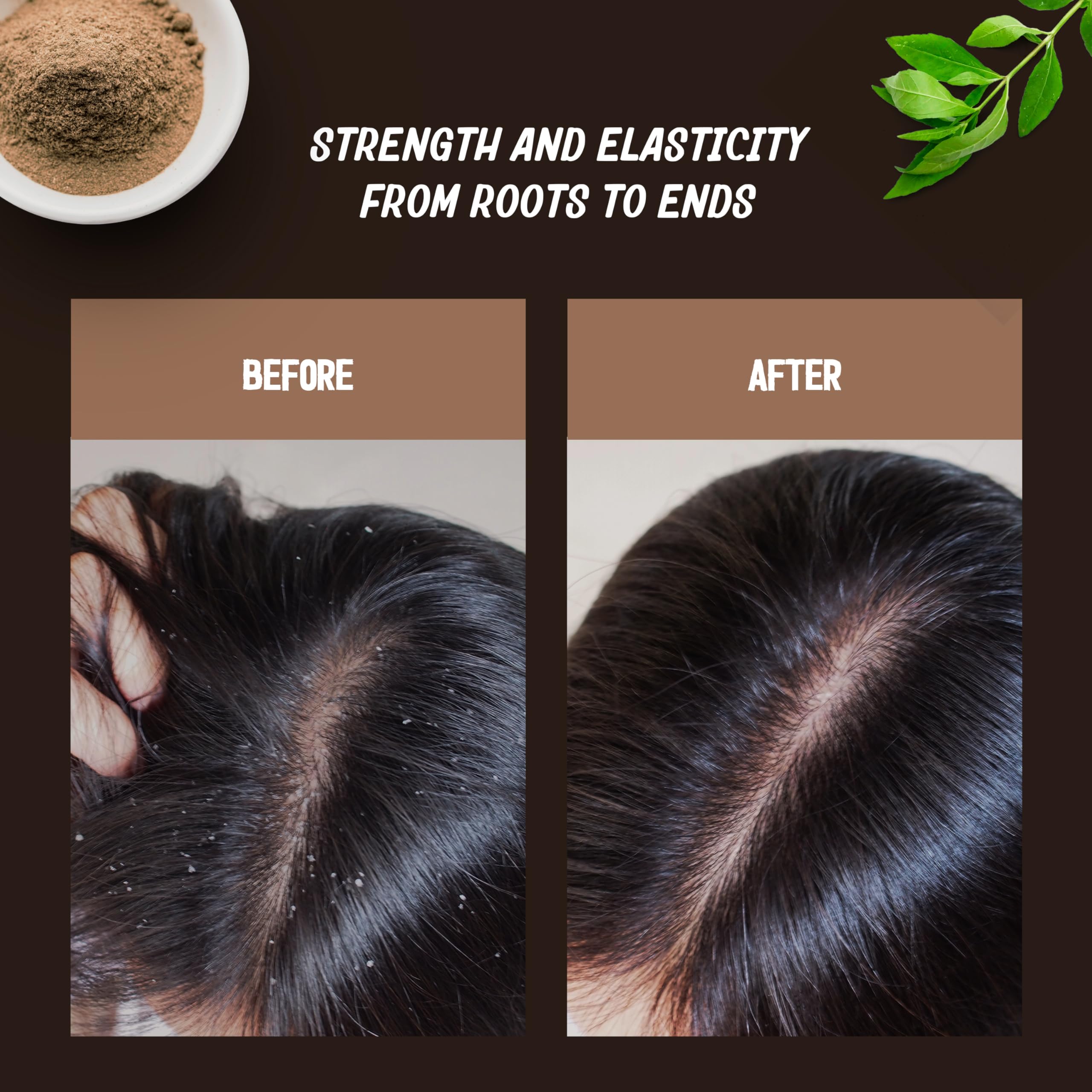 Foto 5 pulgar | Exfoliante Y Limpiador Para Cuero Cabelludo Ayurvita Ayurvita 200 Ml Para Crecimiento Del Cabello - Venta Internacional.