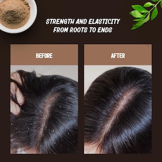 Foto 4 | Exfoliante Y Limpiador Para Cuero Cabelludo Ayurvita Ayurvita 200 Ml Para Crecimiento Del Cabello - Venta Internacional.