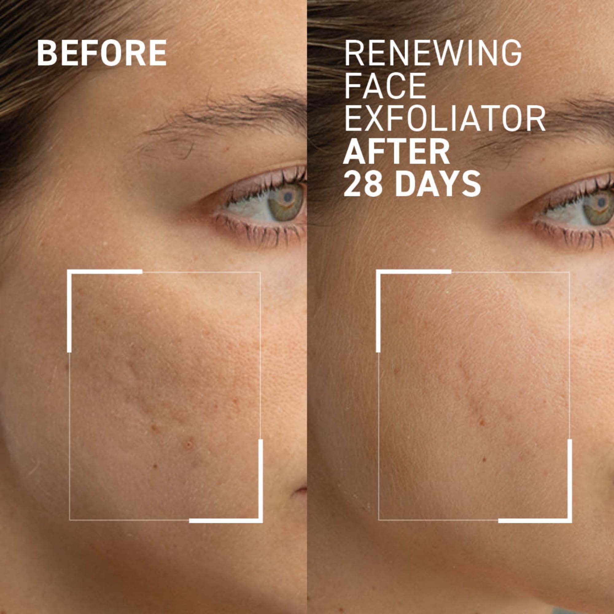 Foto 3 pulgar | Exfoliante Facial Dr. Brandt Microdermabrasion 60 Ml - Venta Internacional.