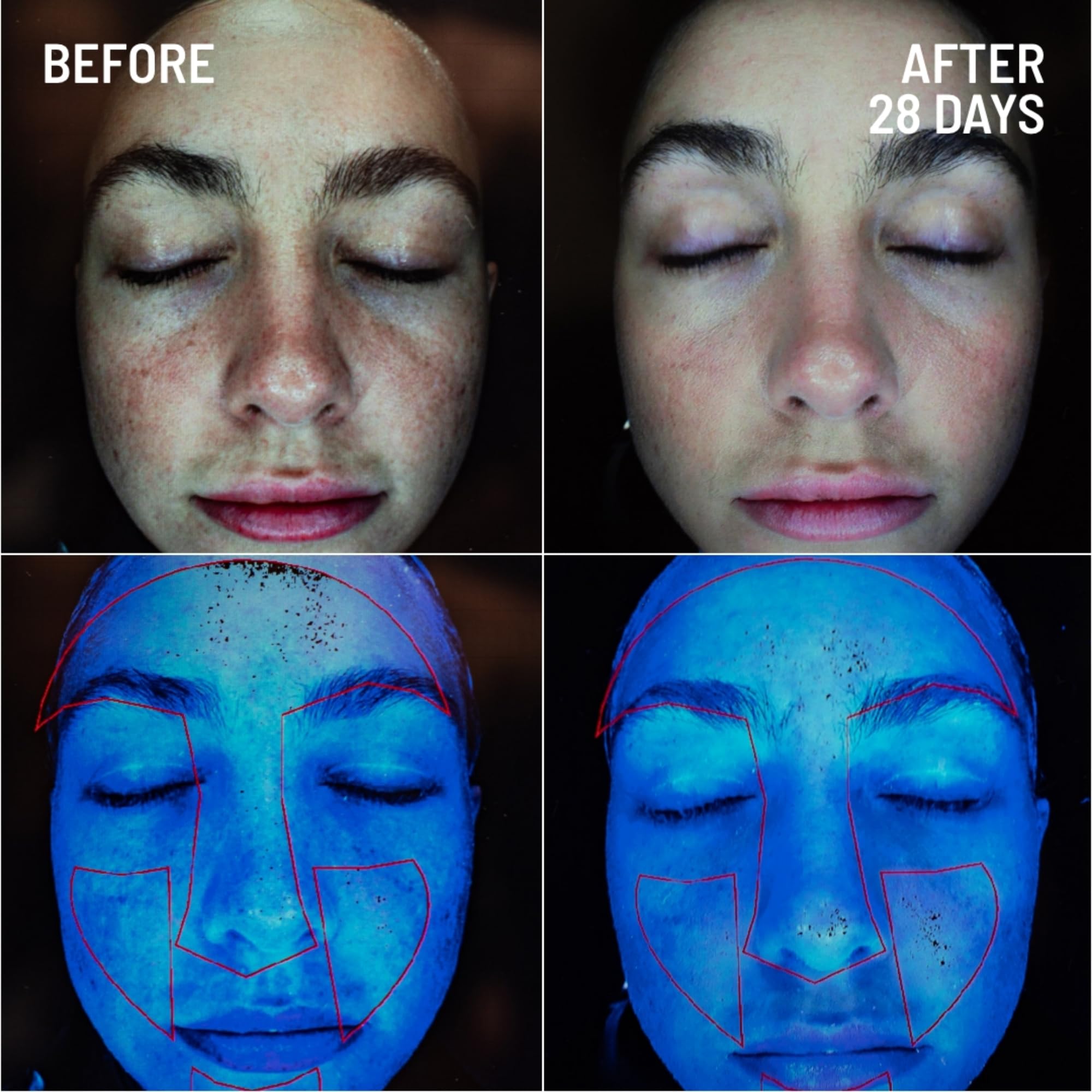 Foto 3 | Exfoliante Facial Dr. Brandt Microdermabrasion 60 Ml - Venta Internacional.