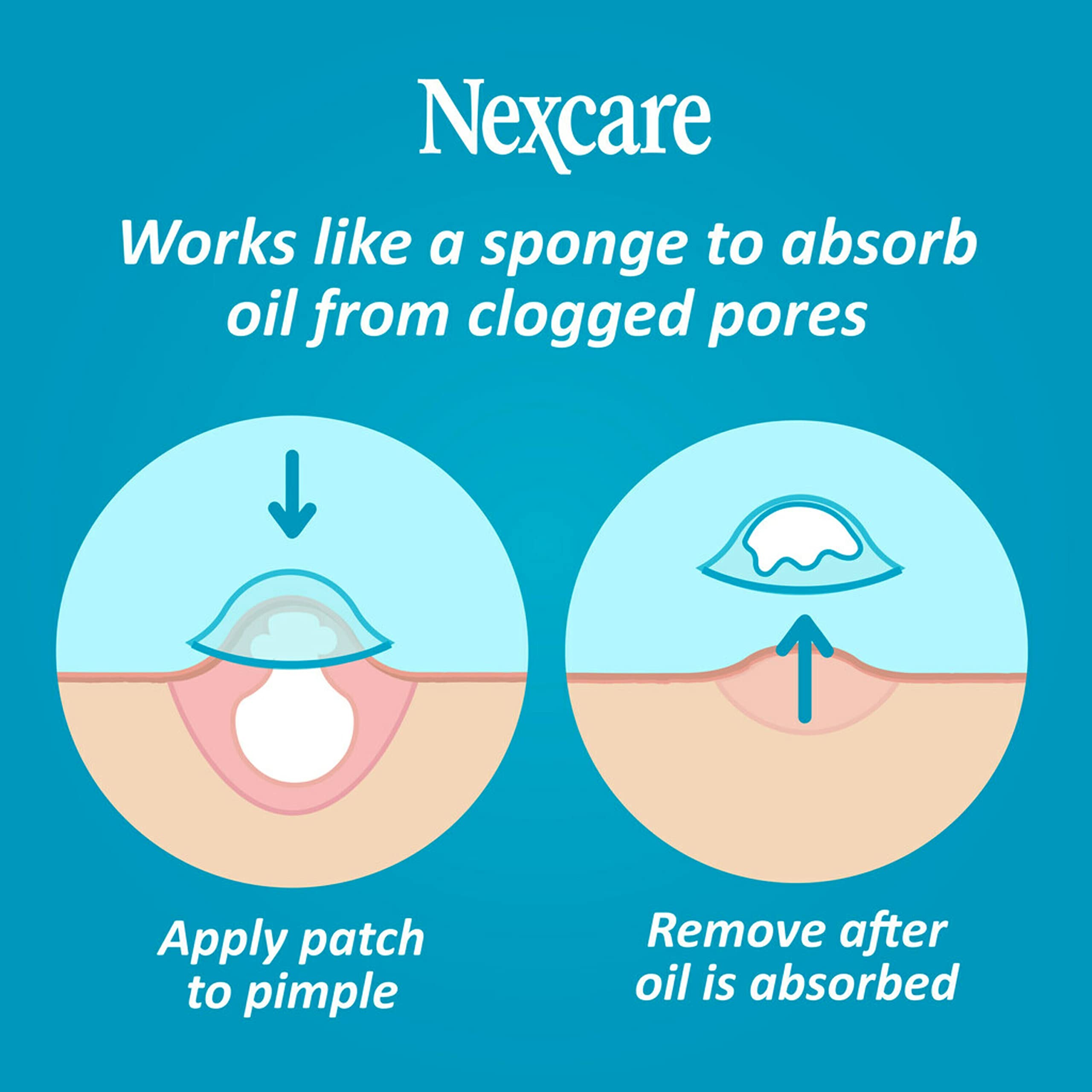 Foto 2 | Cubierta Para El Acné Nexcare Skin Cover Absorbe El Pus Y La Grasa X36 - Venta Internacional.