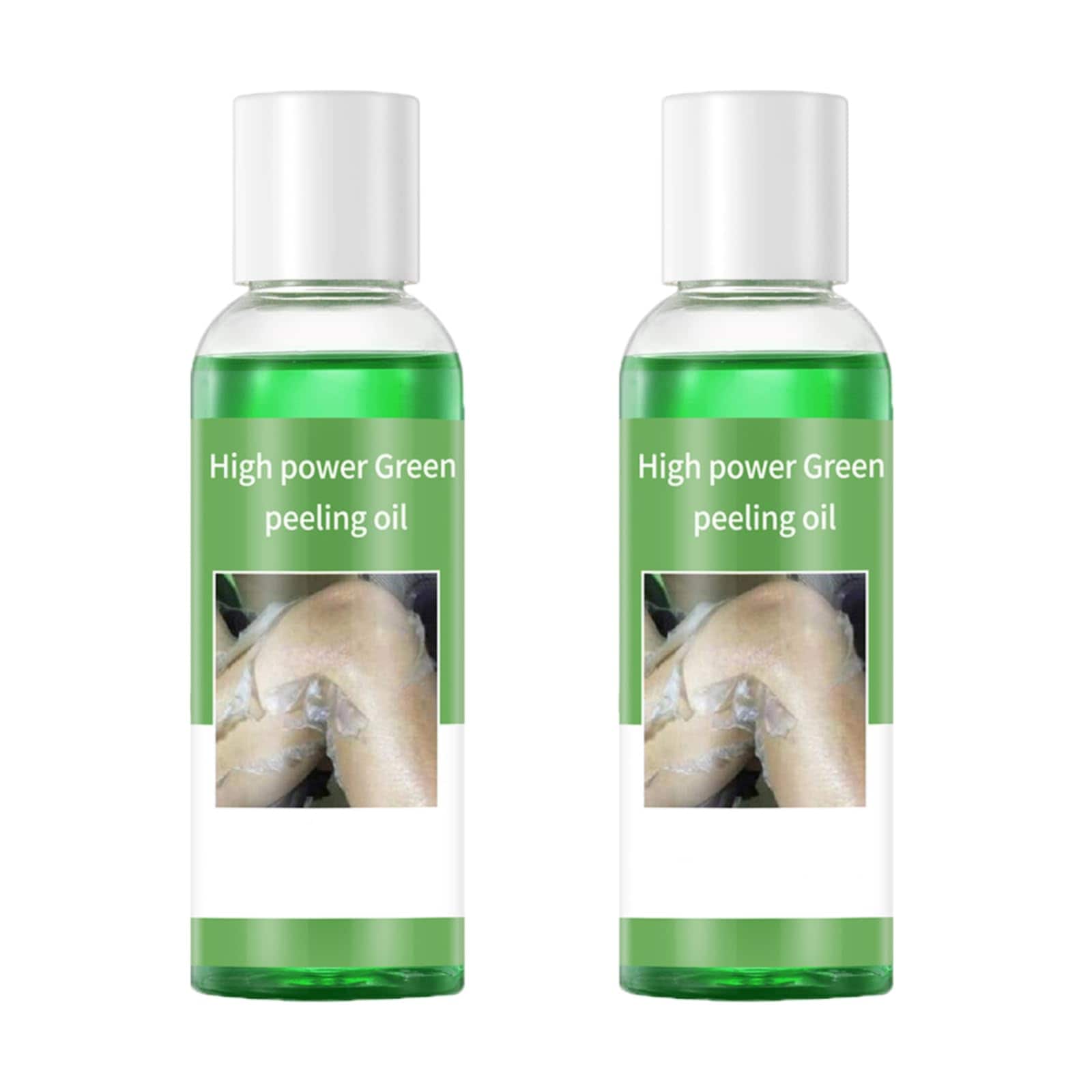 Aceite Exfoliante Verde Extra Fuerte 110 Ml Para Piel Oscura (2 Unidades) - Venta Internacional. $889