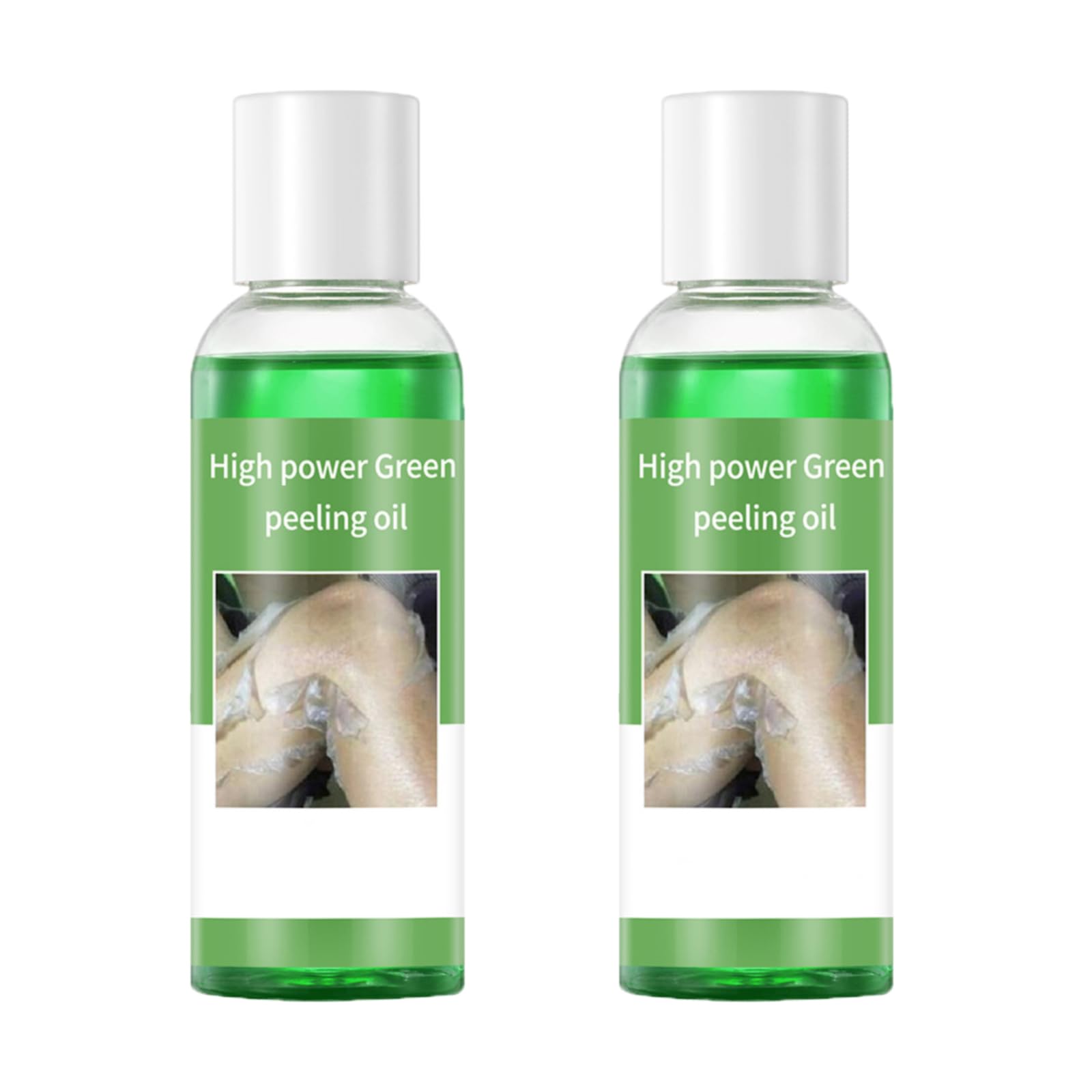 Aceite Exfoliante Verde Extra Fuerte 110 Ml Para Piel Oscura (2 Unidades) - Venta Internacional.