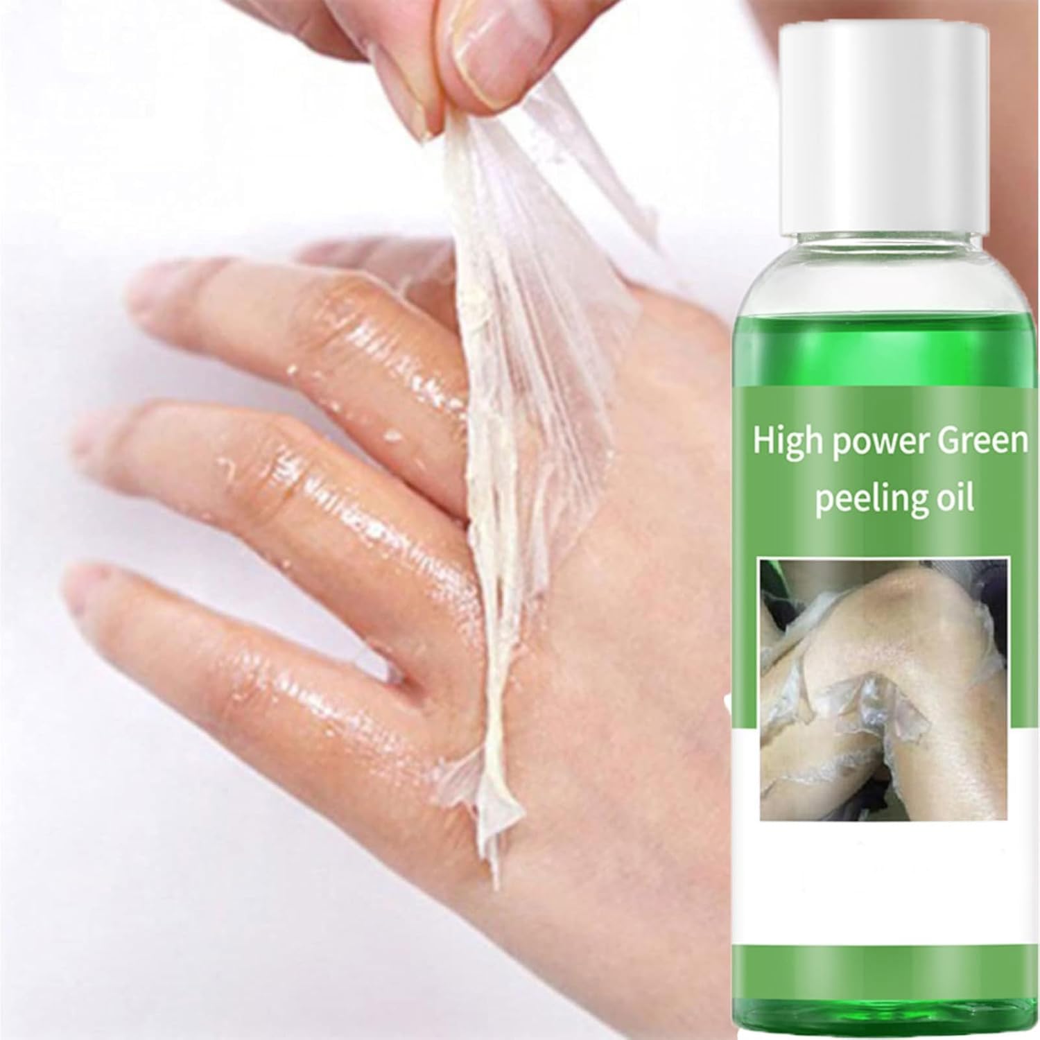Foto 4 pulgar | Aceite Exfoliante Verde Extra Fuerte 110 Ml Para Piel Oscura (2 Unidades) - Venta Internacional.
