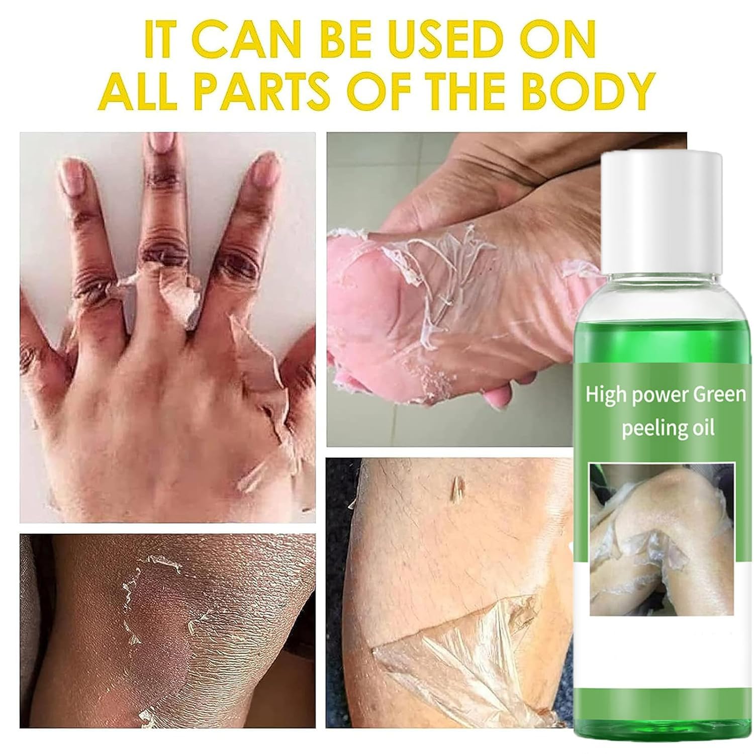Foto 5 pulgar | Aceite Exfoliante Verde Extra Fuerte 110 Ml Para Piel Oscura (2 Unidades) - Venta Internacional.