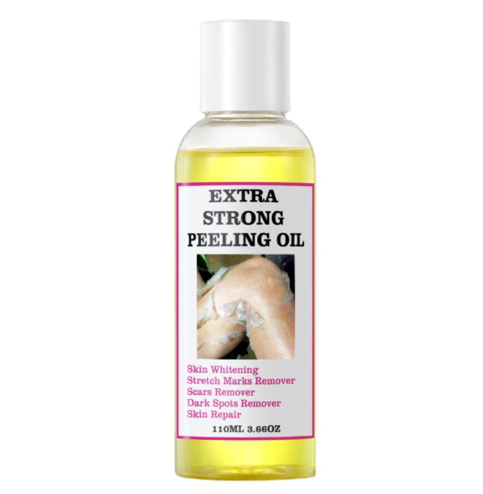 Aceite Exfoliante Yellow Strong Extra Strength 110 Ml - Venta Internacional.