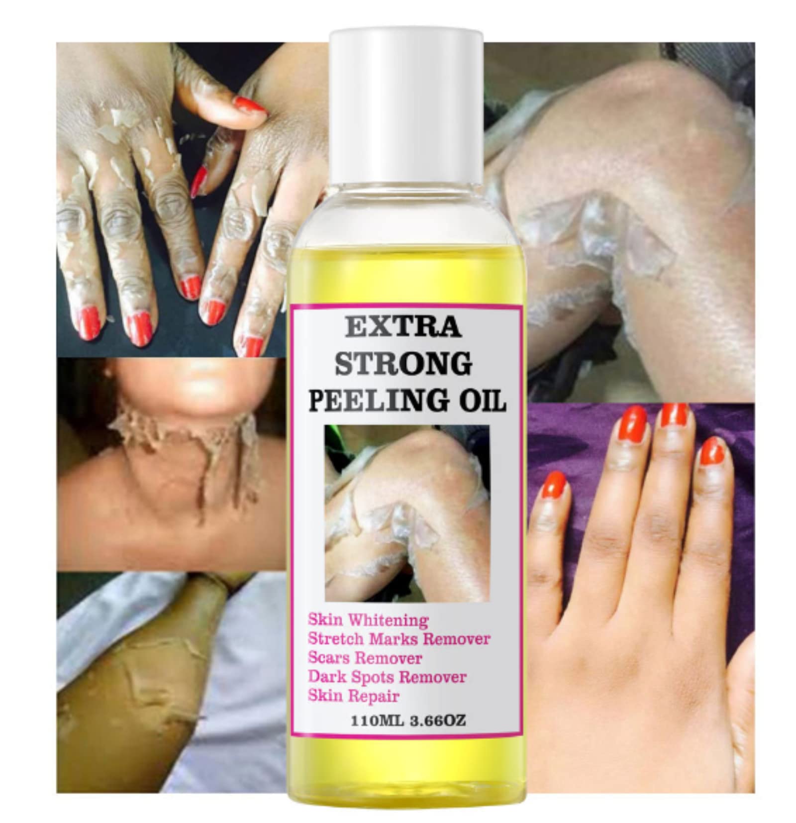 Foto 4 pulgar | Aceite Exfoliante Yellow Strong Extra Strength 110 Ml - Venta Internacional.