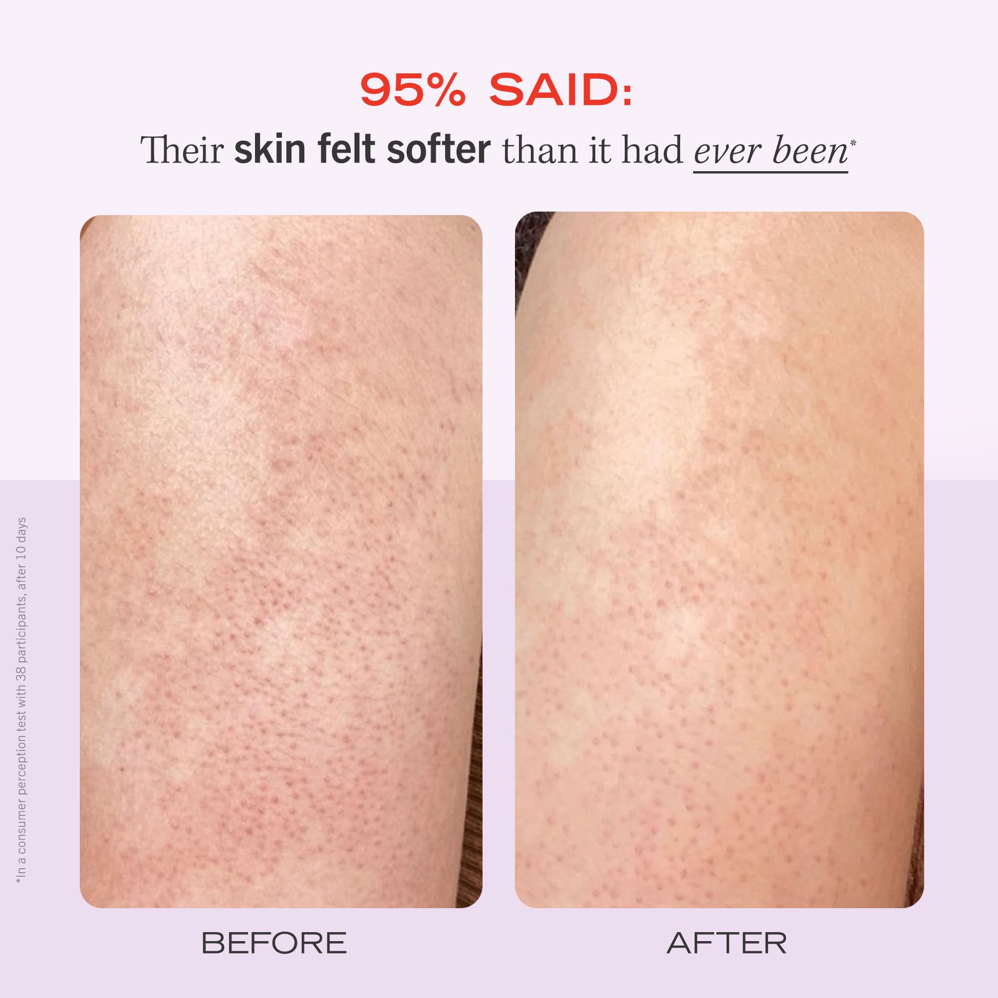 Foto 4 | Exfoliante Corporal First Aid Beauty Kp Bump Eraser 240 Ml Con 10% De Aha - Venta Internacional.