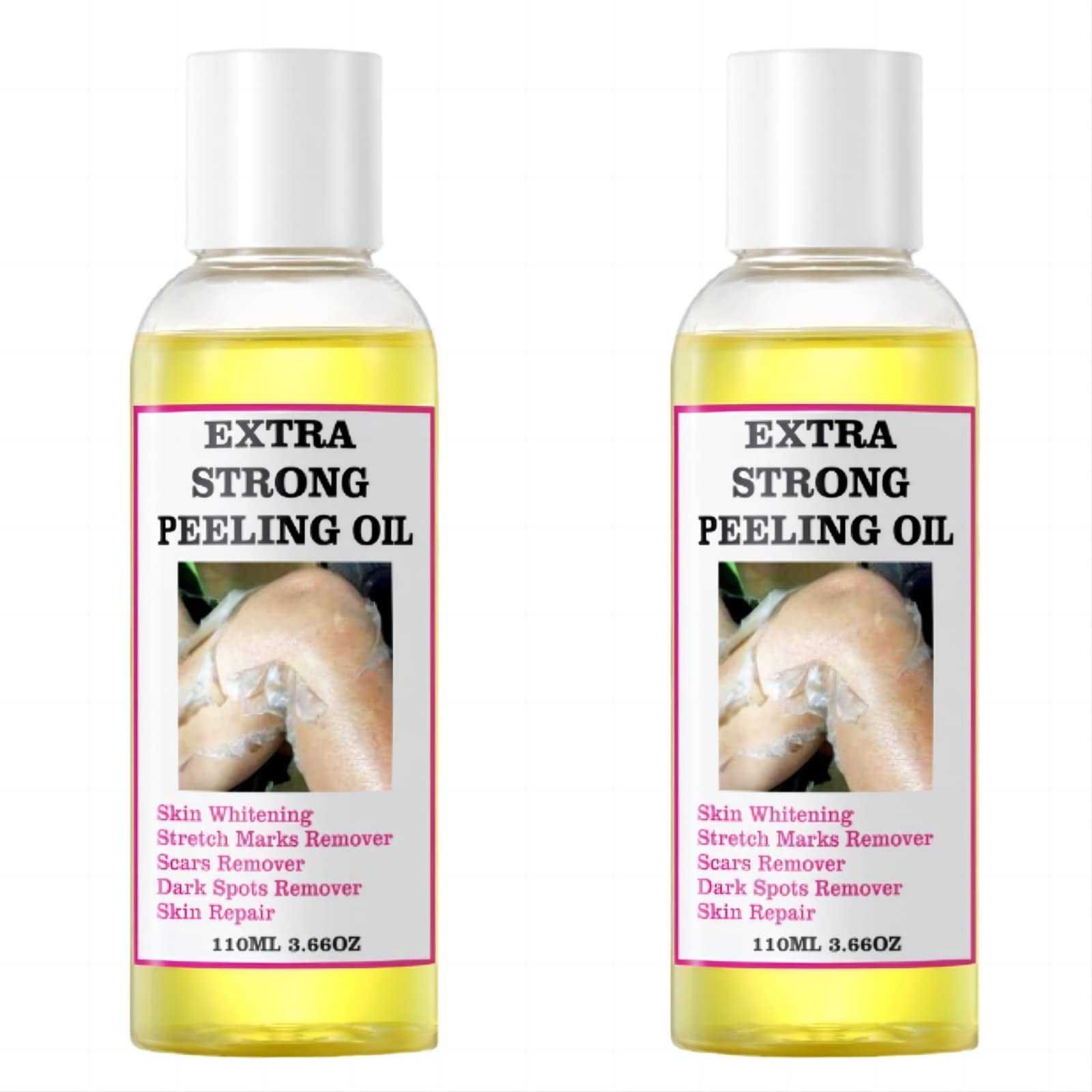 Aceite Exfoliante Amarillo Extra Fuerte 220 Ml Para Todo Tipo De Piel - Venta Internacional.