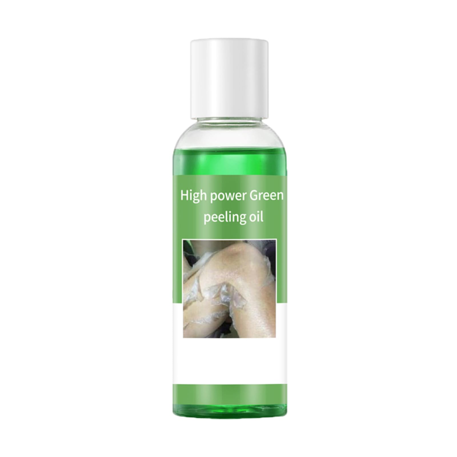 Foto 2 pulgar | Peeling Oil Green Extra Strength 110 Ml Para Piel Oscura - Venta Internacional.