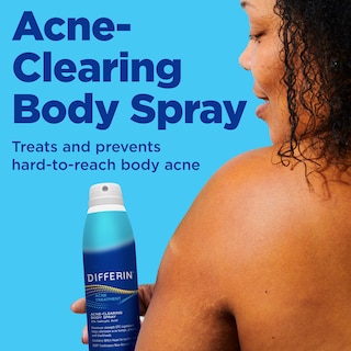 Foto 2 | Spray Corporal Para El Acné Differin 360 Con Ácido Salicílico 180 Ml - Venta Internacional.