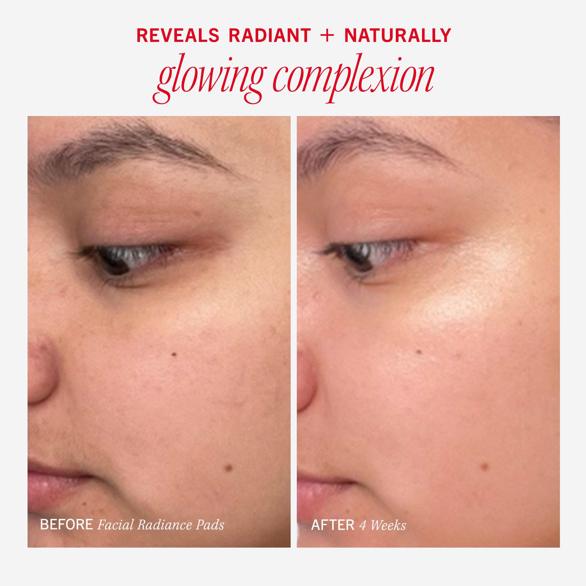 Foto 6 pulgar | Almohadillas Exfoliantes First Aid Beauty Facial Radiance 60 Almohadillas - Venta Internacional.